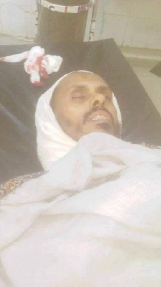 إغتيال الشيخ السلفي ياسر الحمومي في جعار بمحافظة أبين + صورة