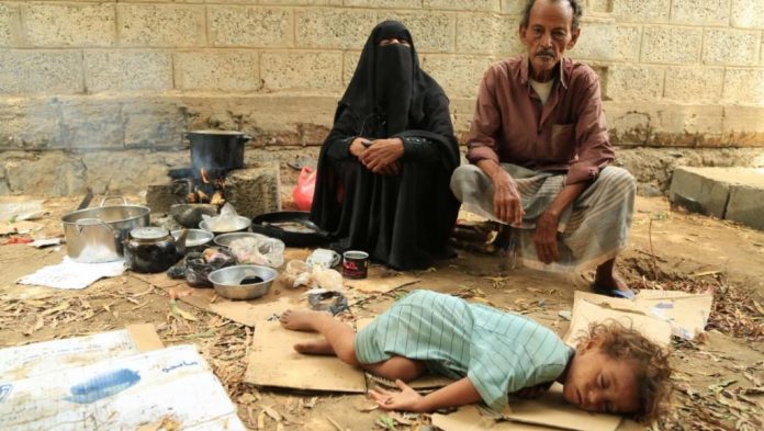 العدوان على اليمن.. إنتهاج إستراتيجة التجويع مقابل عدم الخضوع والإستسلام