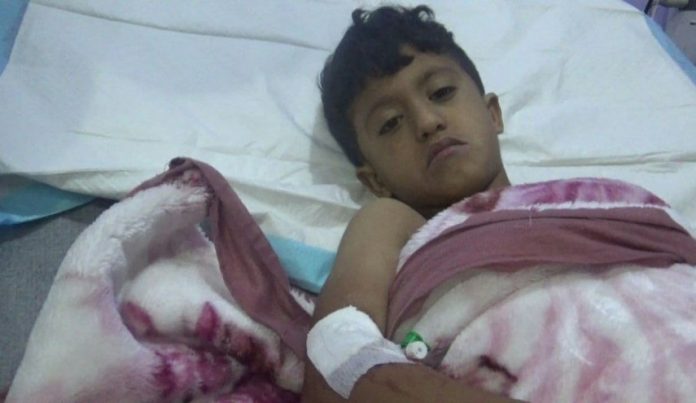 جريمة تعز.. إصابات 3 مواطنين بينهم طفل إثر قذيفة للمرتزقة على حي بتعز