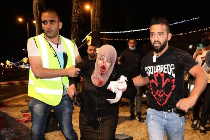 ماذا يحدث بالقدس الليلة.. مواجهات واعتقالات وإصابات تتخطى 80 فلسطيني بفسلطين المحتلة