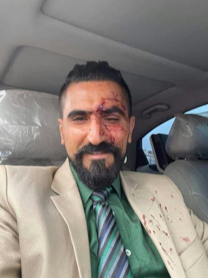 اعتداء وحشي على محامي الضحية عبد الله الأغبري