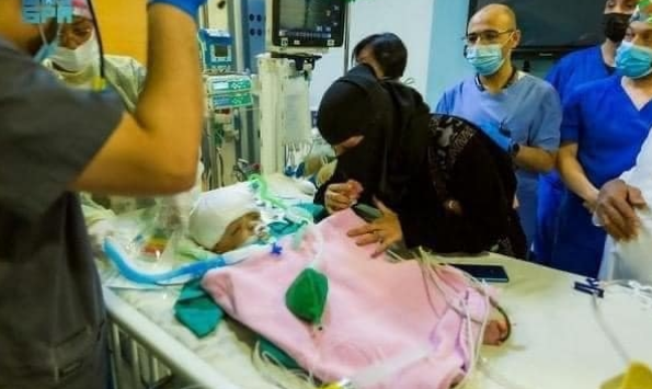 وفاة أحد التوأم السيامي بعد عملية جراحية فاشلة في السعودية