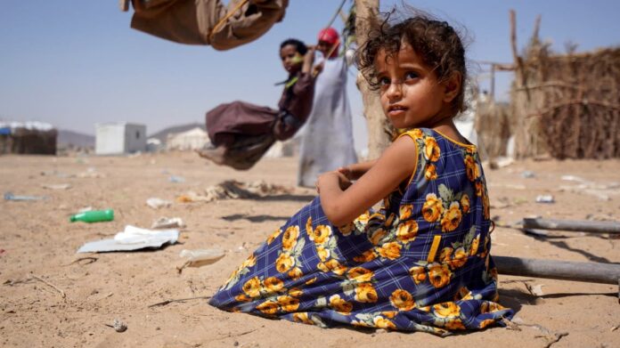 المجاعة تخيم بظلالها على اليمن.. أكثر من 19 مليون يمني يعيشون حياة قاسية