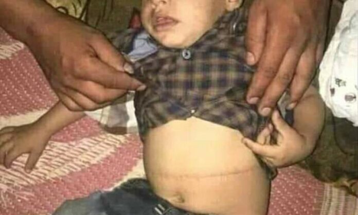 فوضى الجنوب.. عصابات خطيرة تتاجر بكلى الأطفال وكشف وسائل جديدة لاغراق المناطق المحتلة بالمخدرات