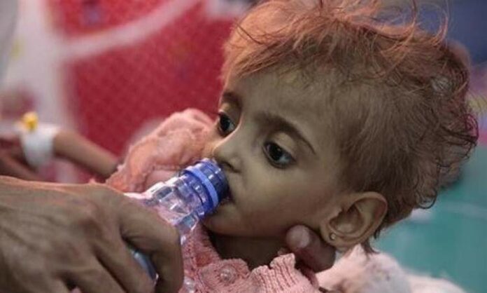 عدد مرعب لوفيات الأطفال في اليمن