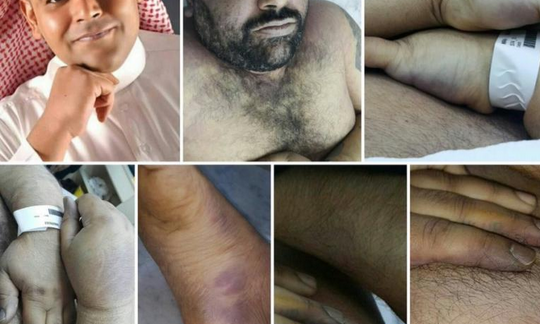 تعذيب أحّد الأسرى في السجون السعودية حتى الموت