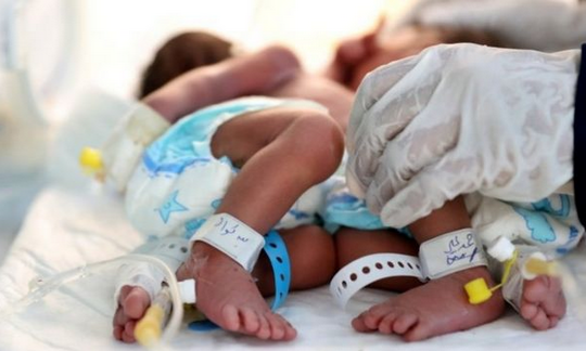 صحة صنعاء: أكثر من 80 مولودا يتوفون يوميا في اليمن