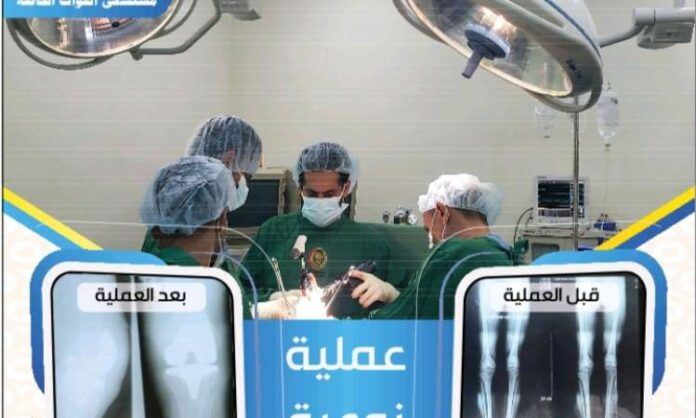 نجاح فريق طبي بمستشفى القوات الخاصة بتركيب مفصل صناعي بالركبة