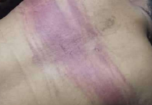 جرائم تعذيب للعشرات في سجون سرية بالخوخة وأحد وجهاء الصبيحة يتعرض للاختطاف والتعذيب في عدن