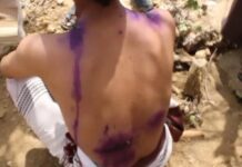 جريمة حدودية مروّعة: مقتل مواطن يمني وتعذيب ستة آخرين على يد الجيش السعودي (صور قاسية)