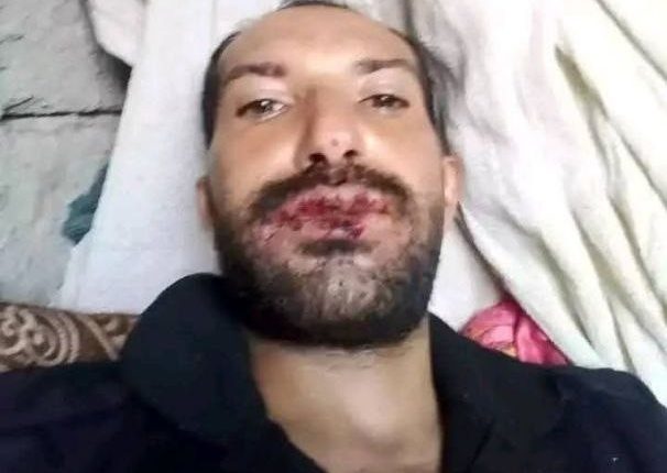 معسكر-الصدرين-في-الضالع..-اختطافات-وتعذيب-ممنهج-تحت-رقابة-عناصر-القاعدة جرائم مروعة في سجون التحالف بالضالع..