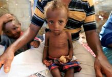 منظمة فرنسية تحذر: اليمن يواجه “كارثة جيلية”.. نصف الأطفال يعانون الجوع والمجاعة تطرق أبواب الملايين