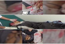 وزارة الصحة تكشف حصيلة ثقيلة للعدوان السعودي.. 193 شهيداً و468 جريحاً منذ بدء التصعيد و69 ضحية خلال 48 ساعة